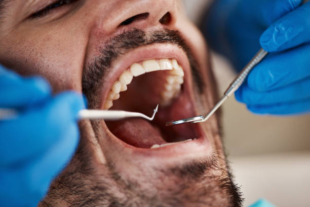 Best Emergency Treatment for Jaw Pain or Injury in Limon, CO